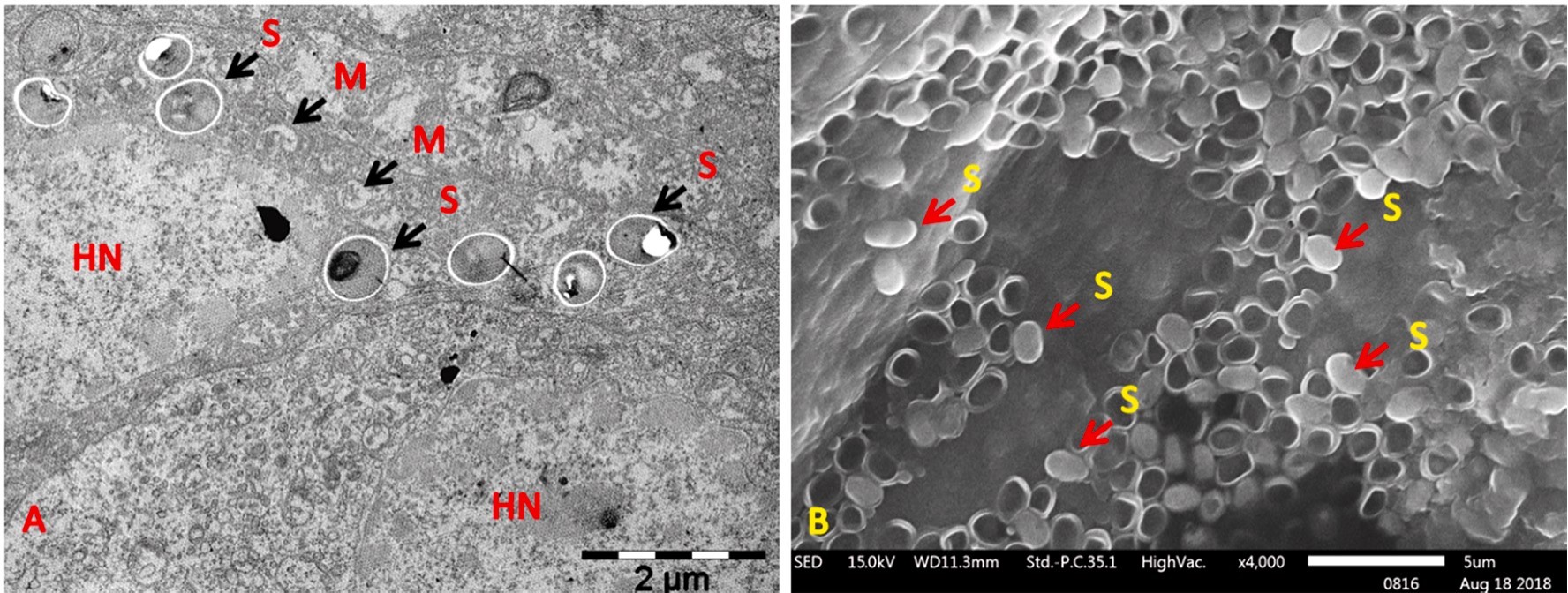 A- TEM của HP đã cảm nhiễm EHP