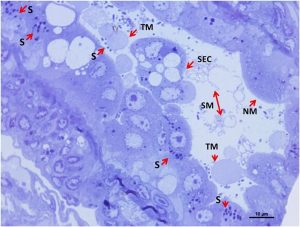 Các phần bán mỏng được nhuộm màu xanh lam toluidine