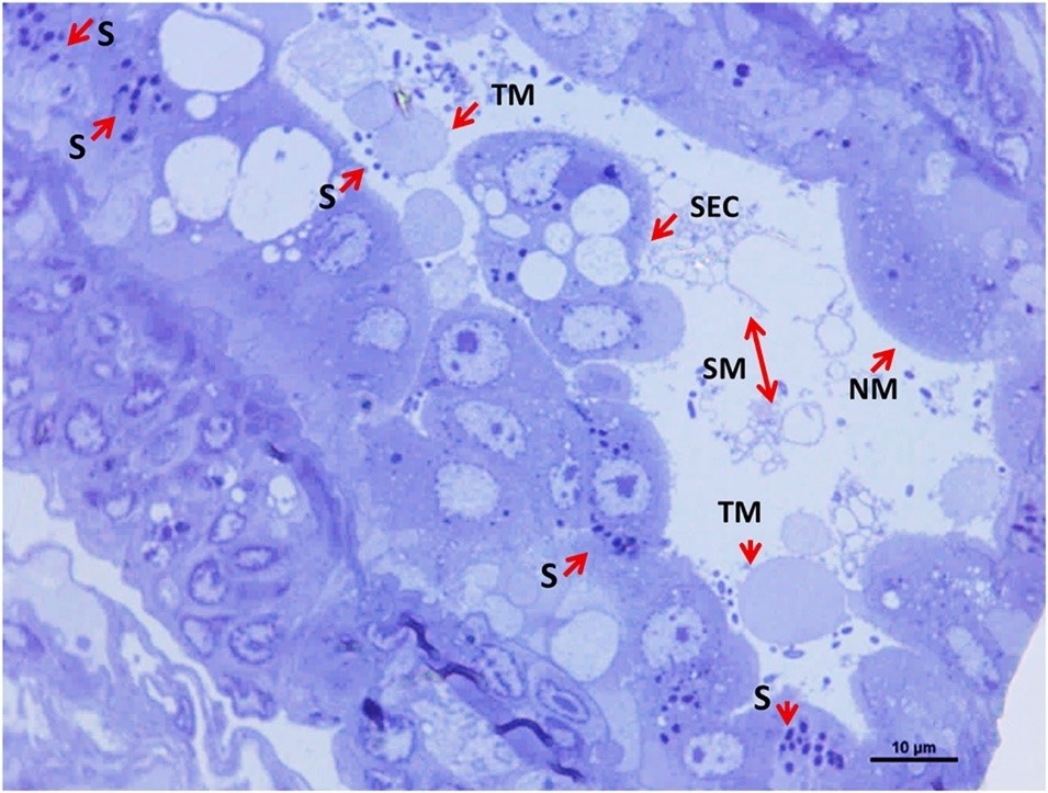 Các phần bán mỏng được nhuộm màu xanh lam toluidine