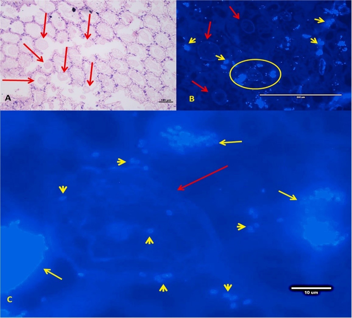 Cấu trúc ATM (mũi tên dài), khối bào tử (mũi tên ngắn), Các bào tử riêng lẻ (đầu mũi tên)