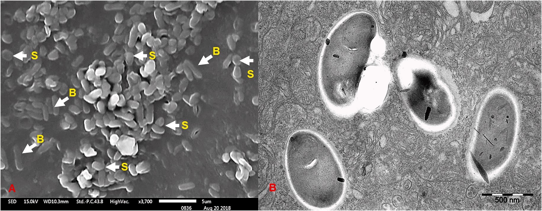 Hình ảnh hiển vi điện tử quét của các sợi phân trắng