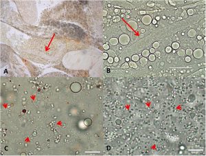 Vùng gắn kết của gan tụy (HP) của tôm bị ảnh hưởng cho thấy cấu trúc ATM