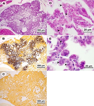 Ảnh chụp gan tụy của tôm P. vannamei bị nhiễm EHP