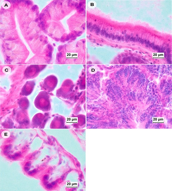 Ảnh kiểm tra mô học của vẹm M. leucophaeata dương tính với EHP