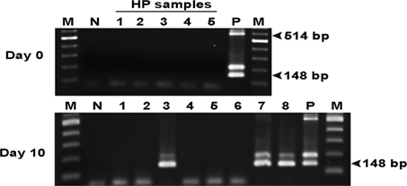 Điện di trên gel agarose bằng cách sử dụng SWP-PCR