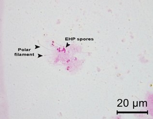 Hình ảnh chụp ảnh phân tích soi tươi của tuyến tiêu hóa