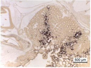 Hình ảnh với độ phóng đại thấp của mô HP bị nhiễm EHP từ xét nghiệm ISH với mẫu tôm con