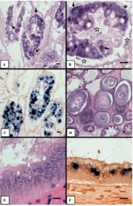 Mô học H&E và EHP lai tạo tại chỗ của các mẫu gan tụy được thu thập từ tôm thẻ chân trắng