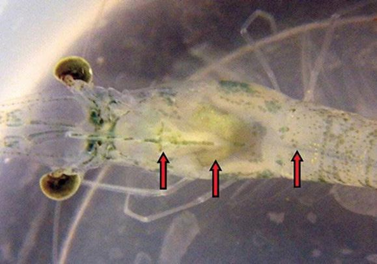 Hình 2. Dấu hiệu tổng quát của AHPNS với dạ dày trống rỗng, HP nhạt và ruột giữa trống rỗng.