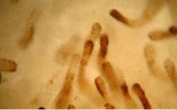 Hình 3. Kính hiển vi trường tối: ống HP bị hắc tố, AHPND mãn tính.