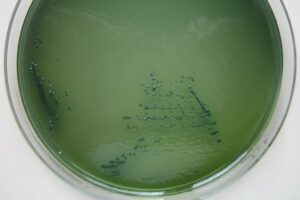 Các nhà nghiên cứu cho biết xét nghiệm nhanh vi khuẩn Vibrio parahaemolyticus (nhóm vi khuẩn Vibrio trong môi trường thạch như hình trên) trong hải sản mang lại giải pháp nhanh chóng, chi phí thấp để ngăn ngừa bệnh tật do thực phẩm gây ra.