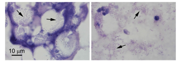 Hình 3 Ảnh chụp vi mô bào tử vi bào tử trong tế bào gan tụy. Bào tử vi bào tử (mũi tên) bên trong tế bào B của biểu mô ống gan tụy (trái) và tự do trong lòng ống (phải). Các tế bào có mặt trong phần này với số lượng ít, tạo ra dấu hiệu sai lệch về mức độ nhiễm vi bào tử nghiêm trọng được chứng minh bằng lai in situ như thấy trong Hình 2. Thanh phóng đại áp dụng cho cả hai hình ảnh.