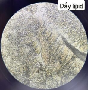 Soi gan tụy tôm dưới kính hiển vi